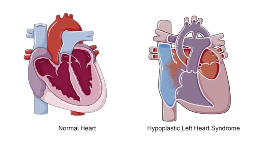 Cardiac signals