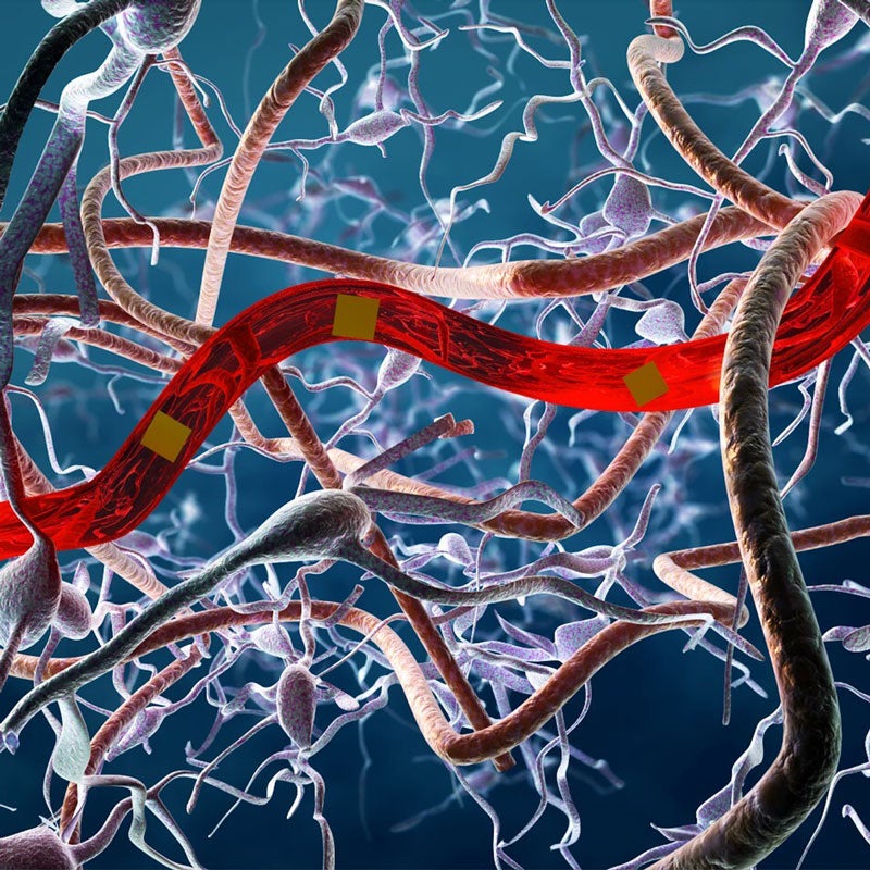 NeuroEngineering